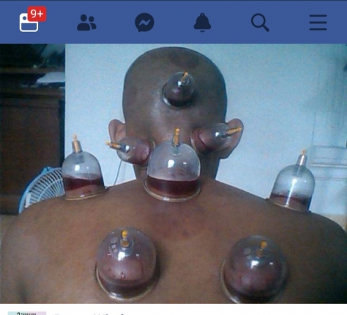 Bekam gangguan Jiwa Skizofrenia Bipolar