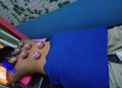 Terapi Bekam Ckarang Bekasi